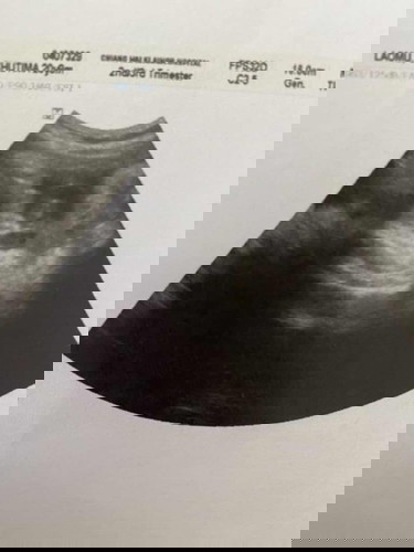 คุณหมอบอกน้องเป็นผู้ชาย