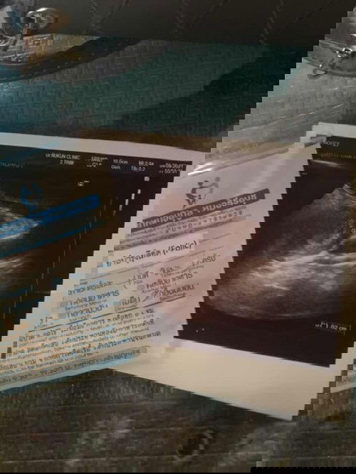 เจอเด็กประมาณกี่วีคค่ะ