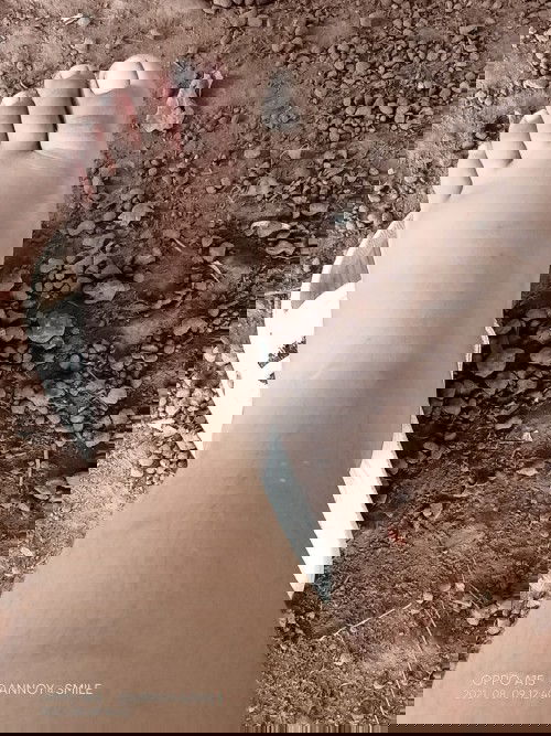 37weekแล้ว ยังไม่แตก
เท้าแม่บวมมากเลย
มีคุณแม่บ้านไหนเป็นเหมือนกันบ้าง ยังไม่มีสัญญาณเตือนอะไรเลย