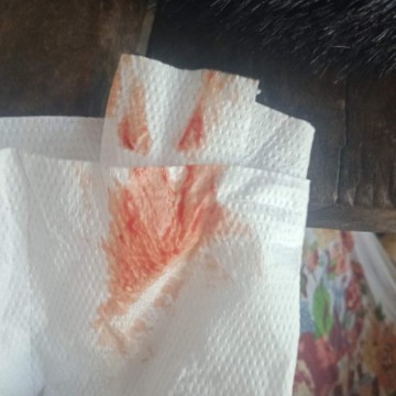 กับมาจากหาหมอ หมอล้วงตรวจปากมดลูก กับมามีเลือดออก แต่เปิดยุแร้วเซนนึง นานมั้ยคะกว่าจะเจบท้อง ท้องคน