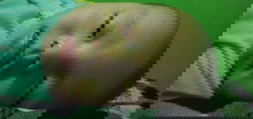 Belum imunisasi BCG & Polio I diumur 3bln