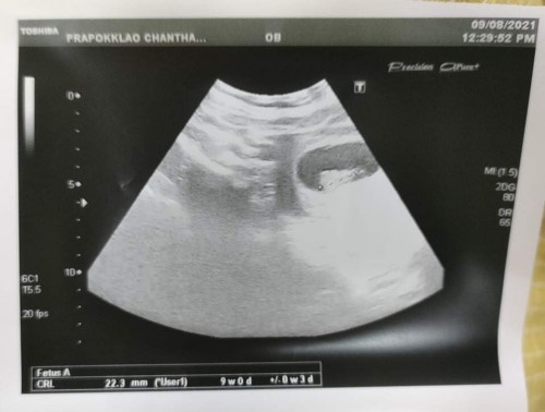 อยากสอบถามแม่ๆ คะ