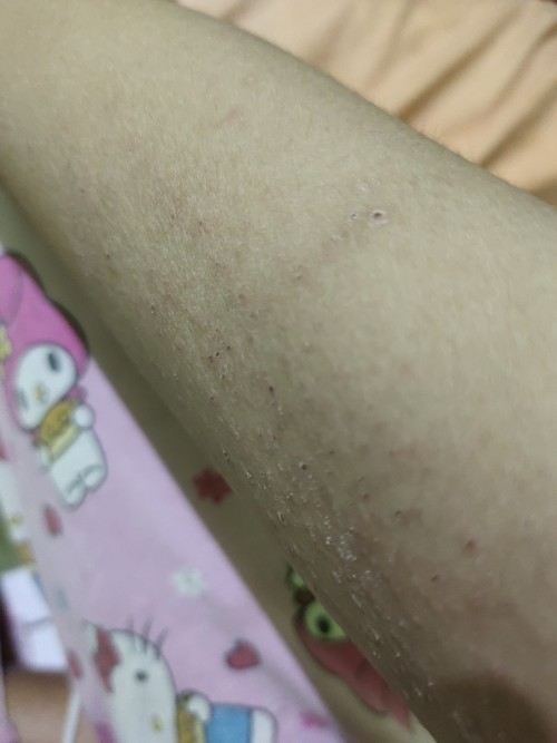 Hamil 5 bulan