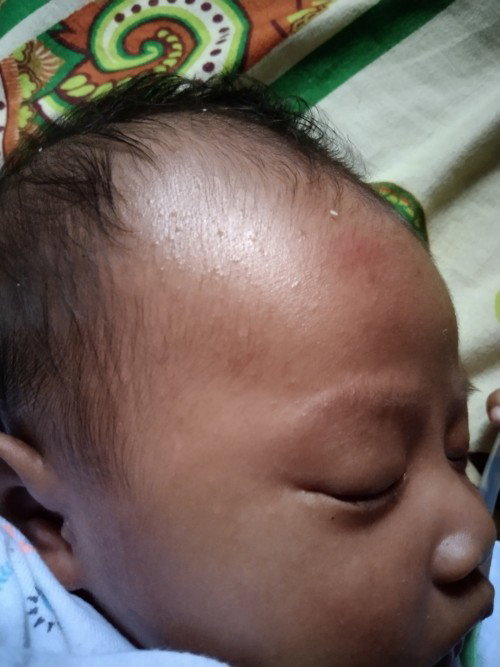 ADA YANG TAU PENYEBABNYA?