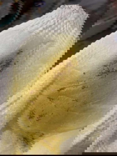 แม่ๆช่วยดูอึน้องให้หน่อยค่ะ ย่าเขาบอกเอากล้วยให้น้องกินแล้วน้องอึแบบนี้เขาบอกมันเป็นปกติของเด็กกินกล้วย แต่แม่ว่ามันเป็นเส้นๆเหมือนเลือดเลยค่ะ น้อง5 เดือน