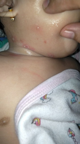 My baby current condition.