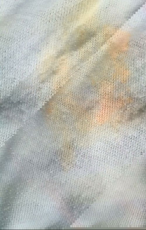 bun tanya kalo flek coklat kayak yg di gambar sangat bahaya ngga atu gimana??maaf jorok