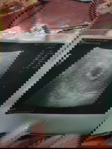 ท้องได้4w4dจะคลอดประมานเดือนใหนค่ะท้องแรกไม่รุ้จิงๆๆค่ะ...ขอบคุนค่ะ