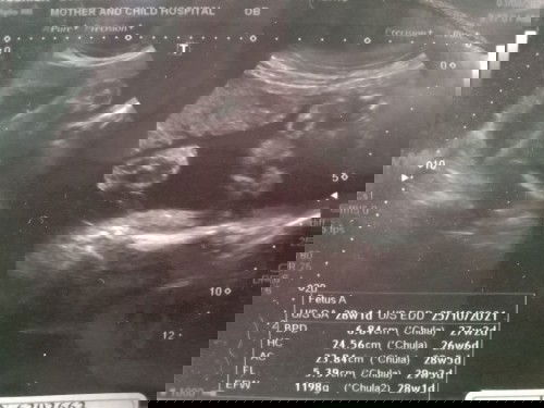 สอบถามคะอยากรู้ว่าน้องเพศอะไร