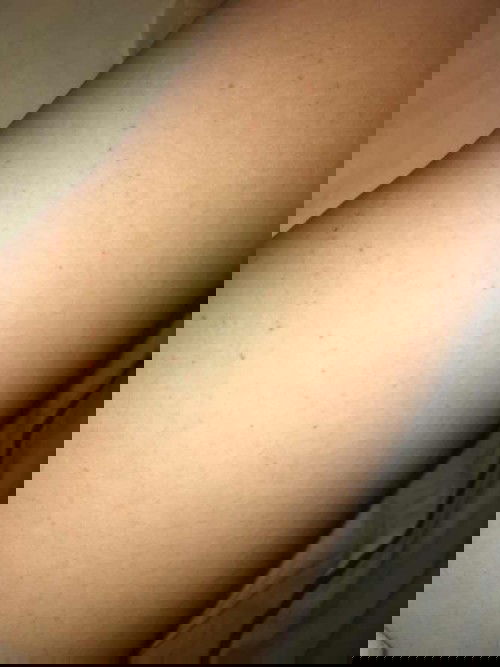 ผื่นขึ้นอันตรายมั้ย ?