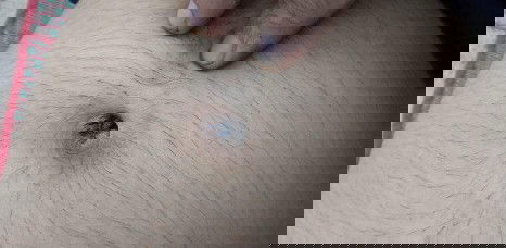 มีวธีทำไห้คราบสะดือหายดำไหมค่ะ พอดีใช้คัตเตอร์บัสกะน้ำเปล่าเอาไม่ออกเลยค่ะ😥😥😥