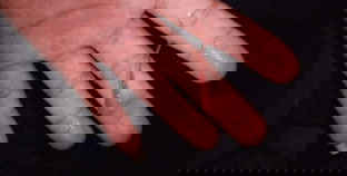 38+3 เจ็บท้องมาๆหายๆ ตั้งแต่ตี 3 พอ 6 โมงเช้ามีมูกเลือดออกคือต้องทำยังไงค่ะ