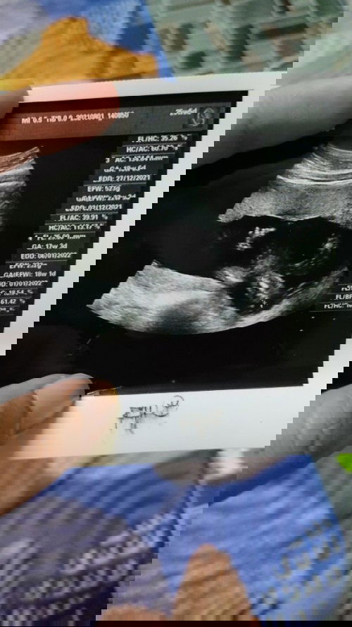 Morning mommy semuaaa 🥰