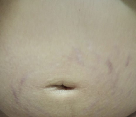 แนะนำครีมหน่อยค่ะ ไม่ไหวแล้ววว