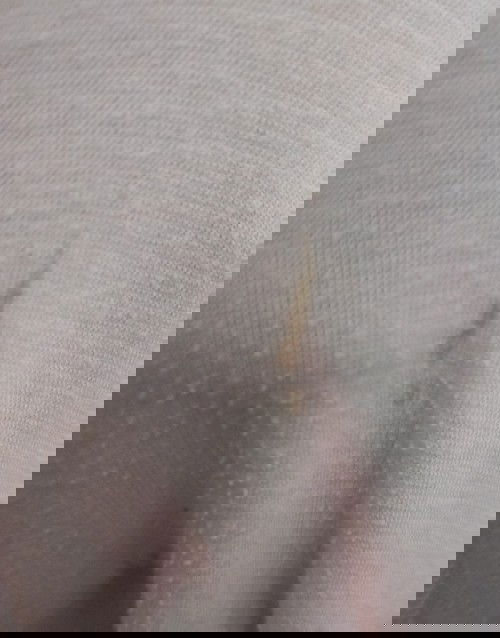 Flek coklat muda saat kehamilan 5 minggu