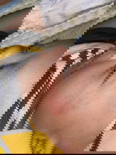 info obat keringat buntet diwaja