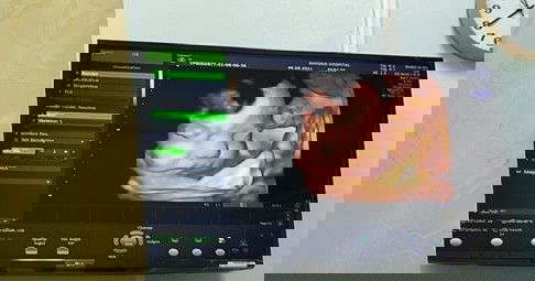 ผม 31w.นน.1,800g.แล้วค๊าาบ แม่ๆเดือนตุลาเป็นไงกันบ้างคะบ้านนี้อุ้ยอ้ายแล้วค่ะ