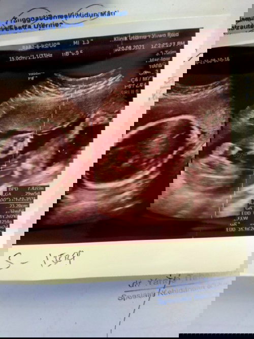 Mohon jangan bully ya