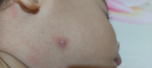 Dikasih obat apa salep apa ya
