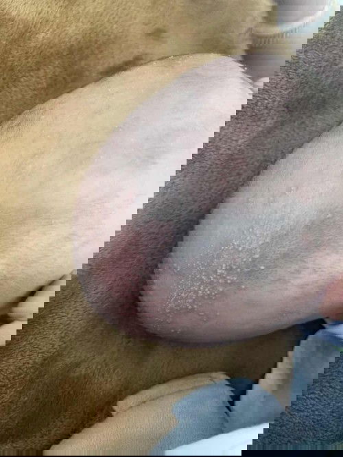 หัวน้องมีผื่นขึ้นค่ะ