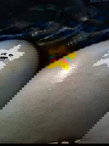 ผื่นแดงขึ้นเต็มท้องเลย