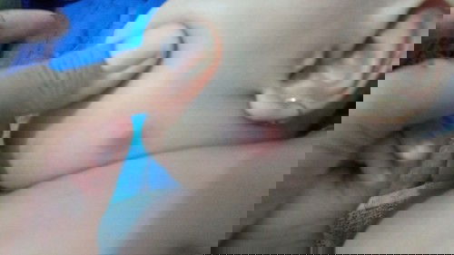 Luka di dekat leher bayi