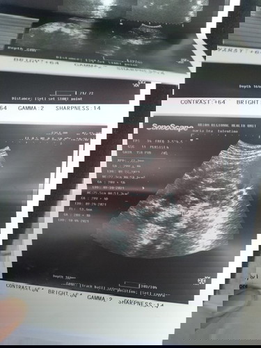 Nag men's ako nung dec.4,2020 tas nag men's ako ng January 1 2021 Anu due date ko non