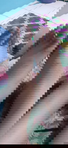 Kaki bengkak setelah melahirkan