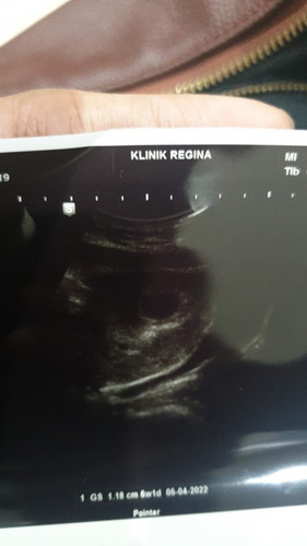 Usia 6 minggu kehamilan