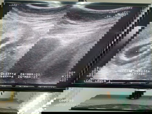 ขอบคุณทุกคนที่ให้คำแนะนำ