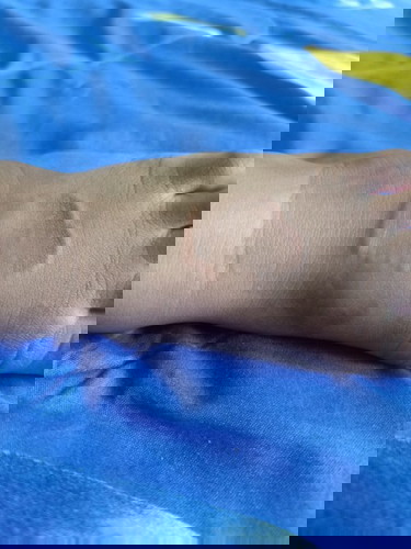 Kaki anak pasca banjir