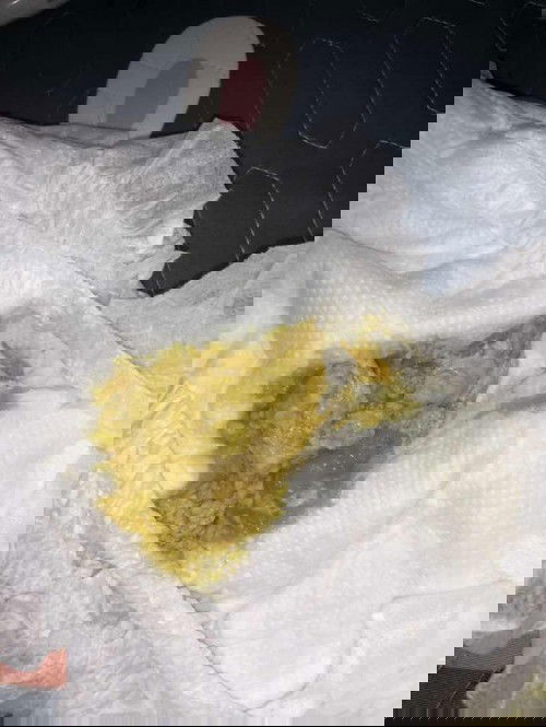 Bé 2thg đi phân không bình thường