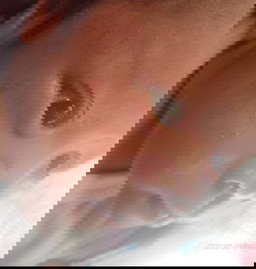 Rashes sa mukha ni baby