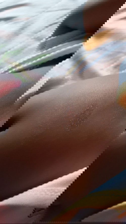 Kulit kering pada bayi