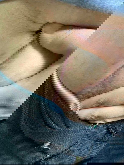 แม่ๆที่ผ่าคลอด