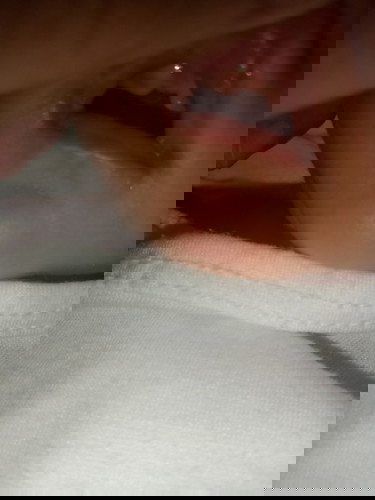 May Gap po yung Gums ng Lo Ko🥺