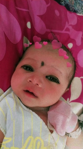 Masalah tindik telinga bayi
