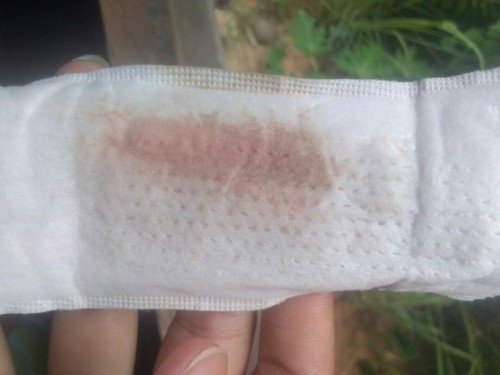 ใช่เลือดล้างหน้าเด็กไหม