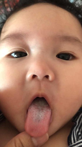 ลูกไม่ยอมกินนม