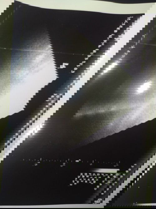 5 weeks belum ada kantung kehamilan