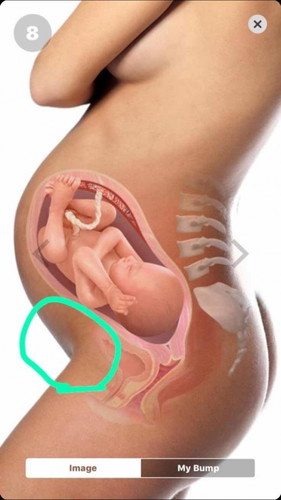 Sakit area ari ari kenapa ye.?