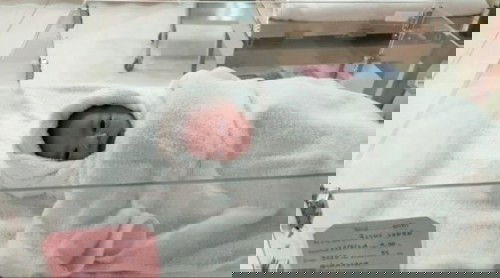 คลอดแล้วจ้า (ผ่าคลอด)