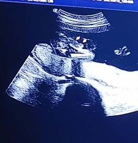 Girl or Boy