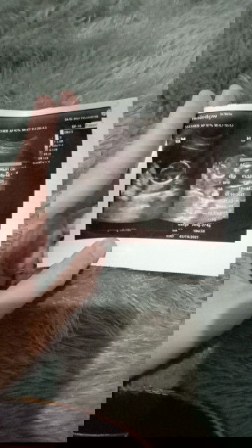 Bagaimana caranya agar posisi plasenta naik ke atas?