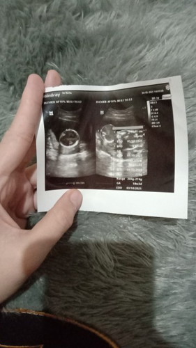 Bagaimana caranya agar posisi plasenta naik ke atas?