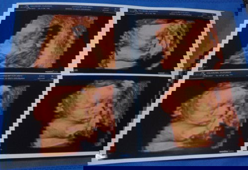 Usg 4D UK 29 week 6 day