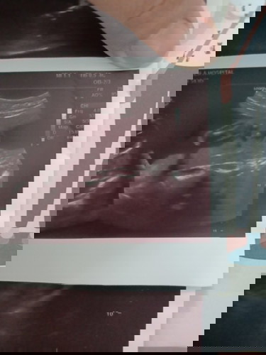 ขอความคิดเห็นจากแม่หลายๆท่านหน่อยค่ะ