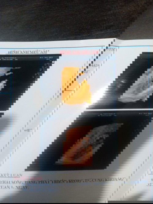 Hôm nay e đc 32w 1ngày