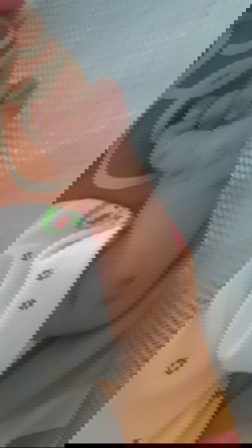 Kulit bayi bermasalah