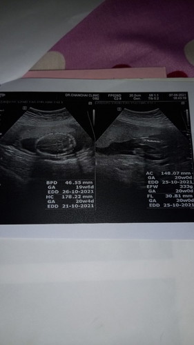 ช่วยดูหน่อยหญิงหรือชายค้ะ  ดูไม่เป้น